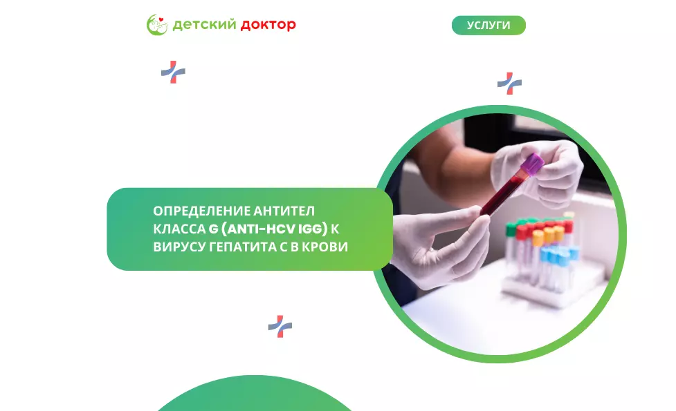 Определение антител класса G (anti-HCV IgG) к вирусу гепатита С в крови